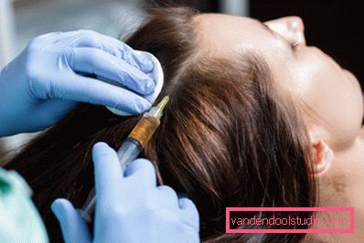 cause di perdita di capelli nelle donne di 30 anni