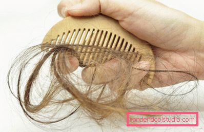 causa di perdita di capelli nelle donne dopo i 50 anni