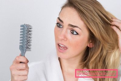 causa di perdita di capelli nelle donne dopo i 40 anni