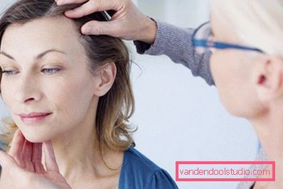 causa di perdita di capelli nelle donne dopo i 40 anni