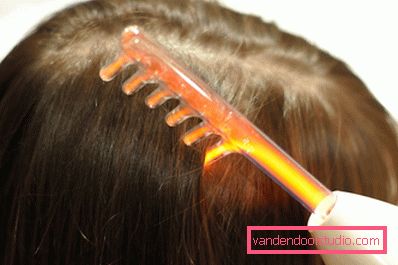 causa di perdita di capelli nelle donne dopo i 40 anni