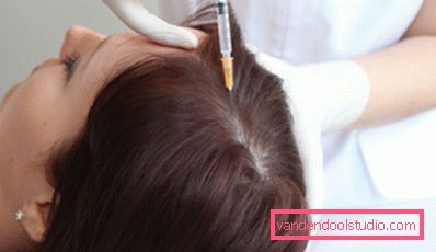 causa di perdita di capelli nelle donne dopo i 40 anni