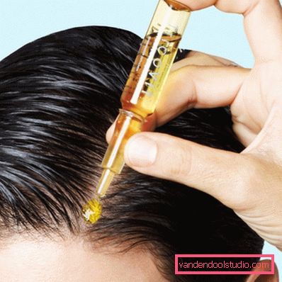 cause di perdita di capelli nelle donne di 30 anni