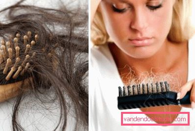 problema di perdita di capelli problema di perdita di capelli