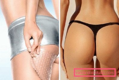 bel corpo senza buccia d'arancia bel corpo senza buccia d'arancia