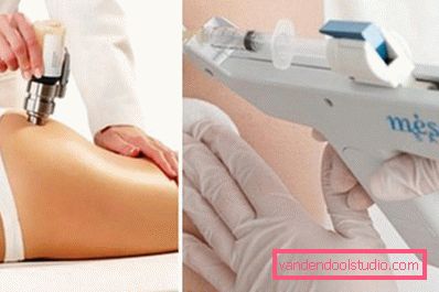 mesoterapia per la perdita di peso mesoterapia per la perdita di peso
