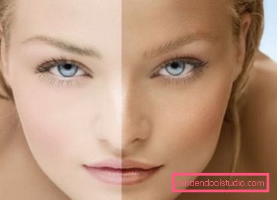 effetto prima e dopo effetto prima e dopo