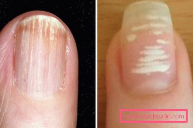 Linee luminose longitudinali e trasversali Linee luminose longitudinali e trasversali