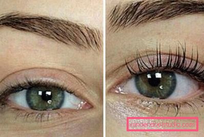 effetto botox effetto botox