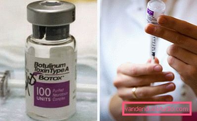 ampolla di botox ampolla di botox