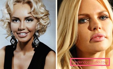 stelle con botox nelle labbra stelle con botox nelle labbra