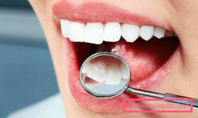 denti perfetti denti perfetti