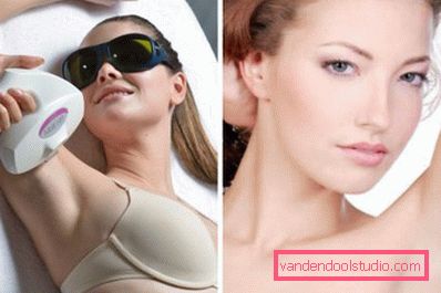sessione laser sessione laser