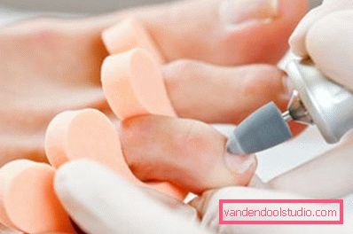 trattamento del piede con macchina per pedicure trattamento del piede con macchina per pedicure