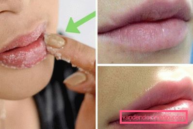 cura delle labbra cura delle labbra