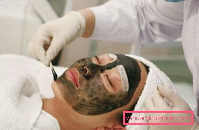 applicazione gel applicazione gel