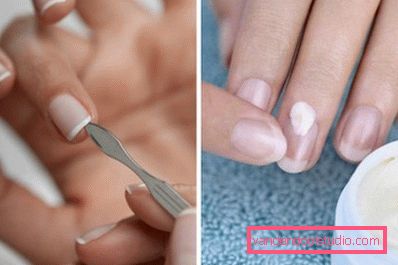 applicare la crema sul piatto ungueale applicare la crema sul piatto ungueale