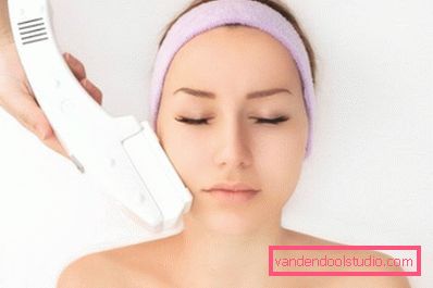 peeling laser della pelle peeling laser per la pelle del viso