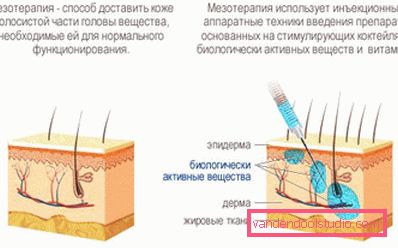 Mesoterapia dei capelli