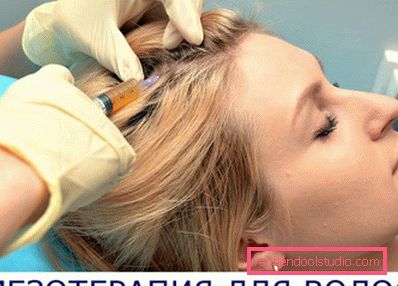 Mesoterapia dei capelli