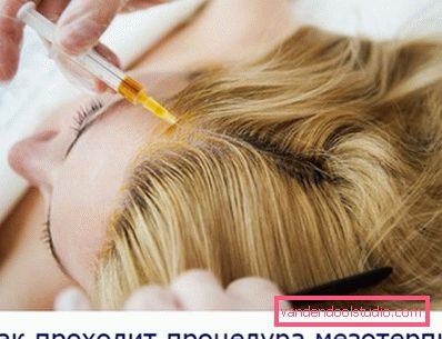 Mesoterapia dei capelli