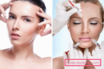 iniezioni di microbotox iniezioni di microbotox
