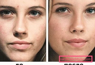 prima e dopo le sessioni prima e dopo le sessioni
