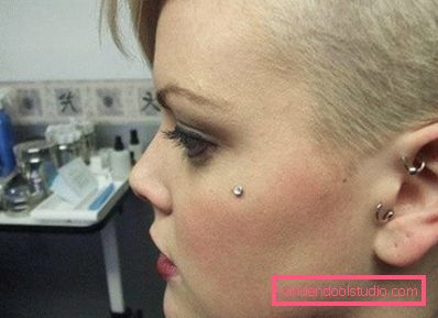 microdermal sul viso microdermal sul viso