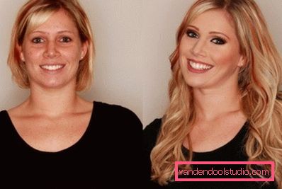 bionda dopo la procedura bionda dopo la procedura