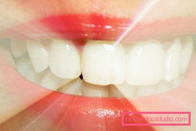 sorriso splendente