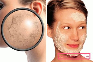 Maschera sulla pelle secca Maschera sulla pelle secca