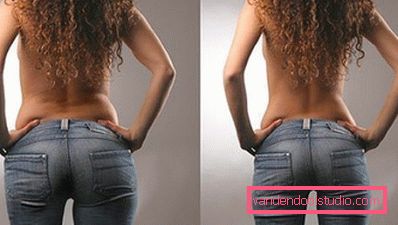 prima e dopo la procedura di dimagrimento dell'ozono terapia prima e dopo la procedura di dimagrimento dell'ozono terapia