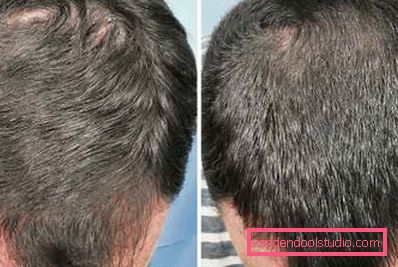 sui capelli maschili sui capelli maschili