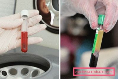 produzione di plasma produzione di plasma