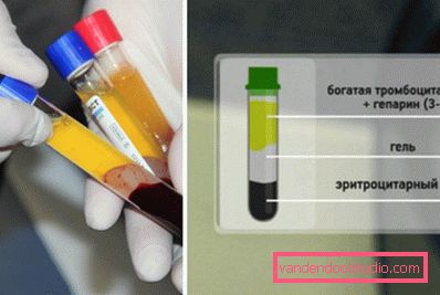 frazioni del sangue frazioni del sangue