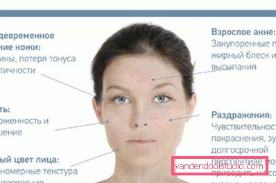 sintomi di stress sulla pelle sintomi di stress sulla pelle