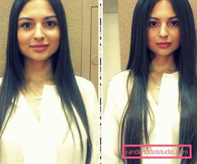 Volume radicale dei capelli Boost Up (Boost UP) - tutto sulla procedura