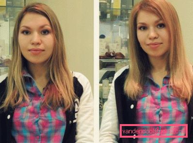 Volume radicale dei capelli Boost Up (Boost UP) - tutto sulla procedura