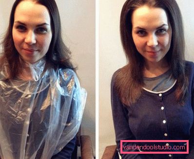 Volume radicale dei capelli Boost Up (Boost UP) - tutto sulla procedura