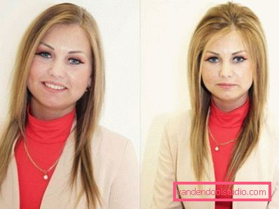 Volume radicale dei capelli Boost Up (Boost UP) - tutto sulla procedura