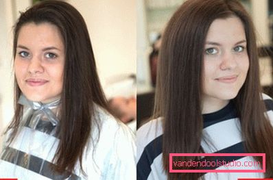 Volume radicale dei capelli Boost Up (Boost UP) - tutto sulla procedura