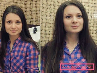 Volume radicale dei capelli Boost Up (Boost UP) - tutto sulla procedura