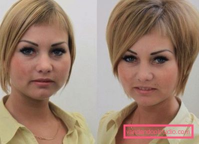 Volume radicale dei capelli Boost Up (Boost UP) - tutto sulla procedura
