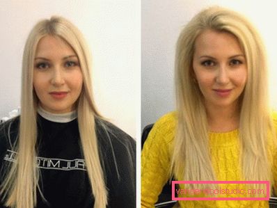 Volume radicale dei capelli Boost Up (Boost UP) - tutto sulla procedura