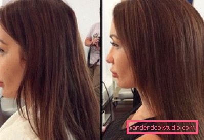 Volume radicale dei capelli Boost Up (Boost UP) - tutto sulla procedura