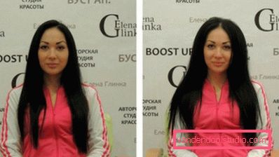 Volume radicale dei capelli Boost Up (Boost UP) - tutto sulla procedura
