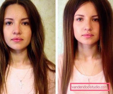 Volume radicale dei capelli Boost Up (Boost UP) - tutto sulla procedura
