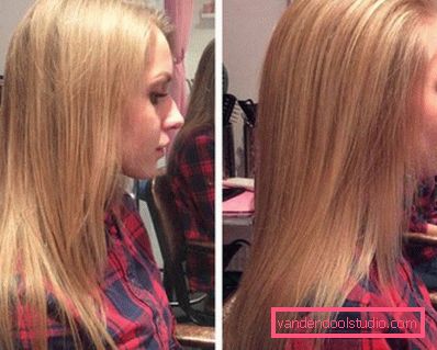 Volume radicale dei capelli Boost Up (Boost UP) - tutto sulla procedura