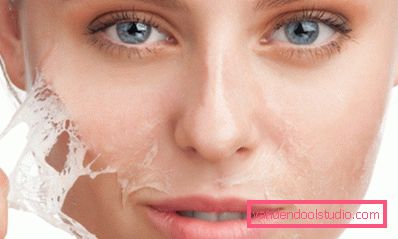 la ragazza ha la pelle Peeling salicilico - bella formula della pelle