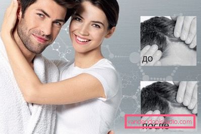 prima e dopo l'uso di shampoo antiforfora prima e dopo l'uso di shampoo antiforfora